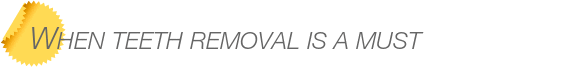 Dentist Bellevue When Teeth Removal is a Must